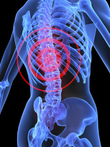 Lumbar Spinal Bracing  Advanced Orthopaedics & Sports Medicine