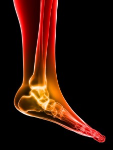 ankle-fracture-symptoms
