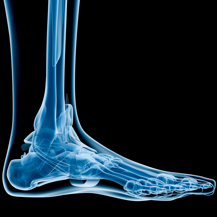 foot-fracture-symptoms