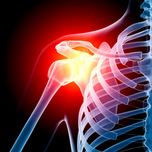 shoulder-joint-replacement