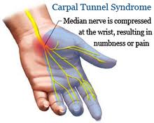 Visit a NJ Orthopedic Surgeon for relieve from Carpal Tunnel Syndrome