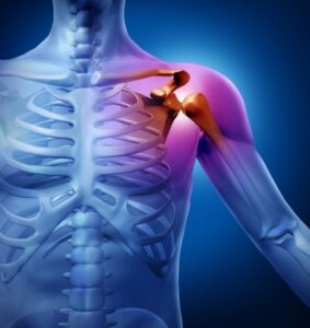 Antibiotic Prophylaxis after Total Joint Replacement (TJR)
