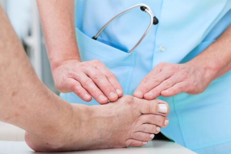 How Bad Is Too Bad When It Comes to Bunions?