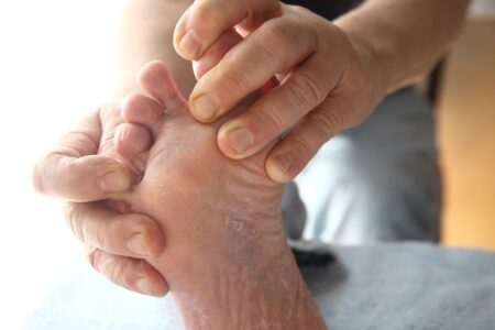 Diabetic Foot: Prevention and Treatment