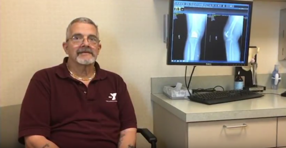 Frank – Patellofemoral Joint Replacement in Knee