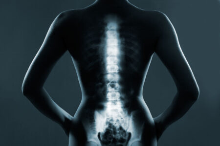 What Is Minimally Invasive Spine Surgery?