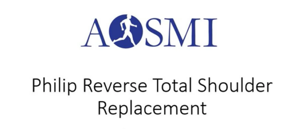 Reverse Shoulder Replacement surgery performed by Dr. Alan S. Nasar