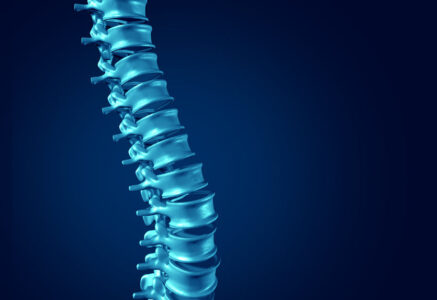 What is Spinal Fusion?