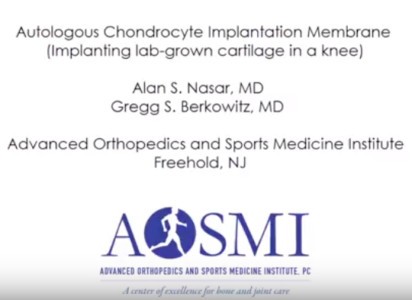 MACI Autologous Chondrocyte Implantation Surgical Video – Dr. Alan Nasar and Dr. Gregg Berkowitz