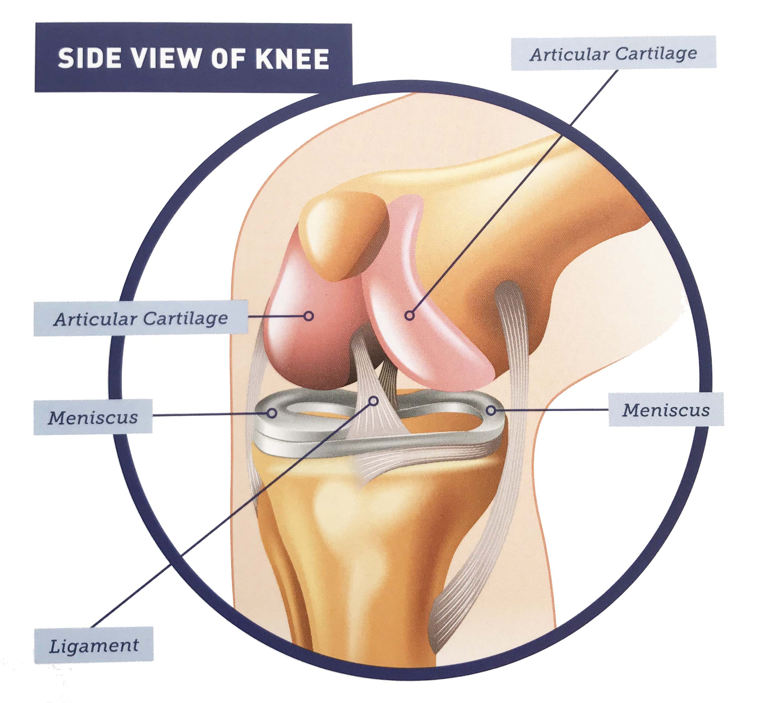 knee repair