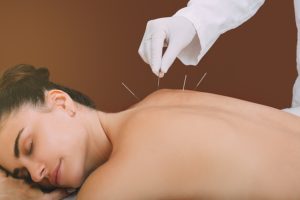 Acupuncture Freehold NJ