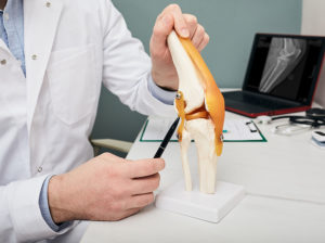 Knee surgeon holding model of knee joint and pointing to ACL
