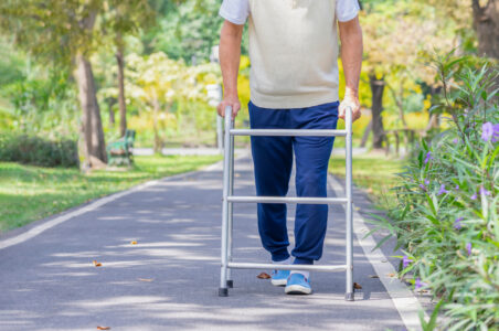 How Physical Therapy Supports Orthopedic Recovery in Summer